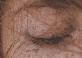 El Sol puede dañar la piel y afectar la estética de la dermis. Foto: Pixabay